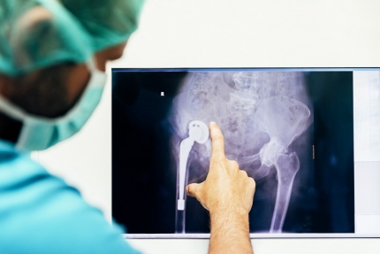 Se stárnutím populace narůstá poptávka po biomateriálech, které nahradí nebo podpoří nemocemi a léty poškozenou kosterní soustavu.