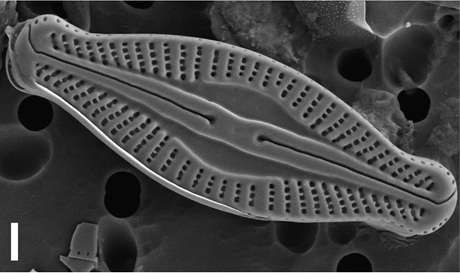Microcostatus naumannii (Husted) Lange-Bertalot Microcostatus naumannii (Husted) Lange-Bertalot