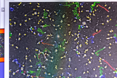 Pohyb spermií pod mikroskopem Pohyb spermií pod mikroskopem