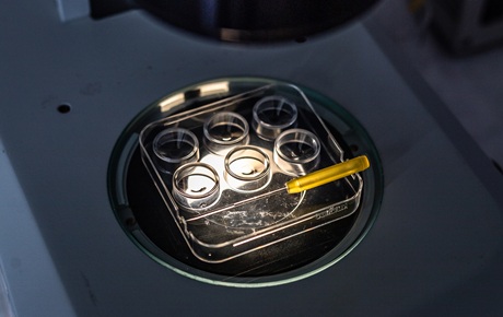 Miska s živným médiem Miska s živným médiem