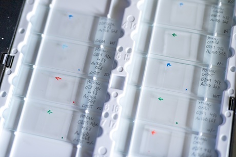 Sklíčka s roztěry spermií Sklíčka s roztěry spermií